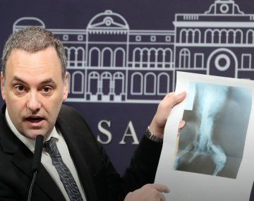 El Gobierno denunció un fraude millonario con las pensiones por invalidez