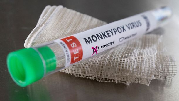 Confirman dos nuevos casos de viruela del mono en Argentina