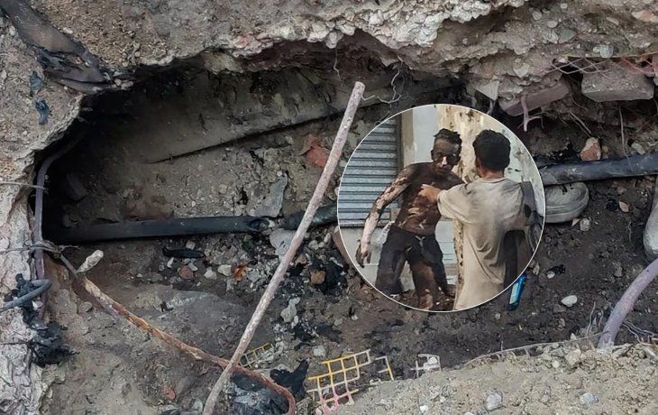 Intentaba robar cables de luz y quedó electrocutado: tiene el 90% del cuerpo quemado