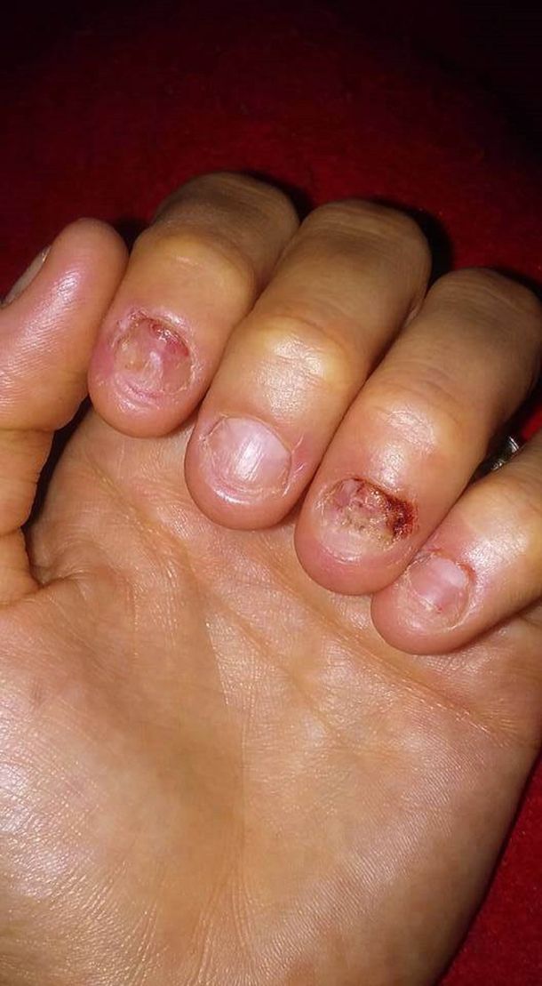 Tiene las manos así y pide ayuda por Facebook