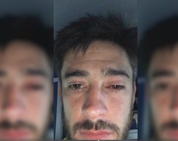 Pablo Pérez, afectado por los gases arrojados en los incidentes