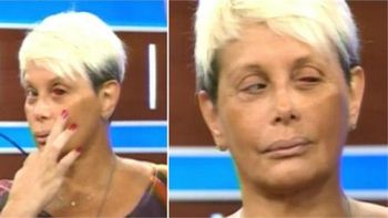 ¿que le paso en el ojo a carmen barbieri? ¿que le paso en el ojo a carmen barbieri?
