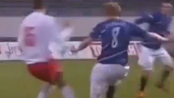 la lesion mas impresionante: se rompio la tibia la lesion mas impresionante: se rompio la tibia