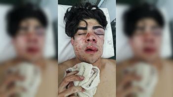 El adolescente de 18 años terminó internado El adolescente de 18 años terminó internado