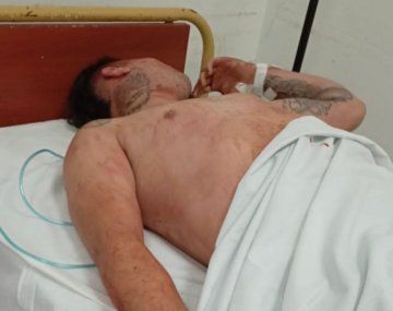 Violencia: más de 10 colombianos del Cali gravemente agredidos por barras de Racing