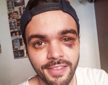 Castellari fue atacado el 1º de diciembre por un grupo de ocho hombres