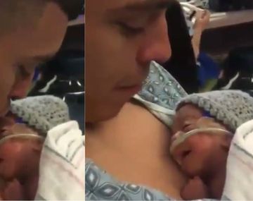 Sonrisa de un bebé prematuro