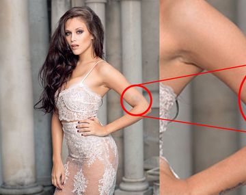 Barbie mostró un moretón en una producción