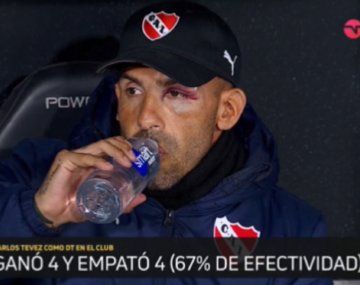 La imagen de Tevez tras el accidente doméstico que sufrió