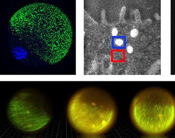 Los fuegos artificiales que son generados por un espermatozoide y un óvulo
