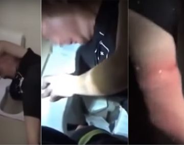 Quiso sacar el celular del inodoro y se le trabó el brazo