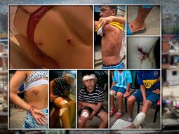 tras la represion a murgueros en la 1-11-14, seguridad iniciara una investigacion tras la represion a murgueros en la 1-11-14, seguridad iniciara una investigacion