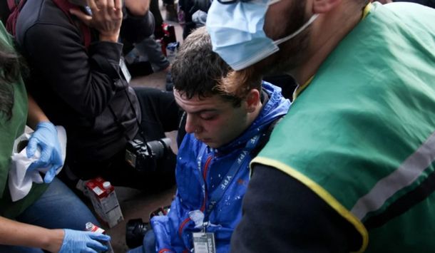 Según Lilia Lemoine, el fotógrafo reprimido por la Policía interceptó el gas pimienta con la cara