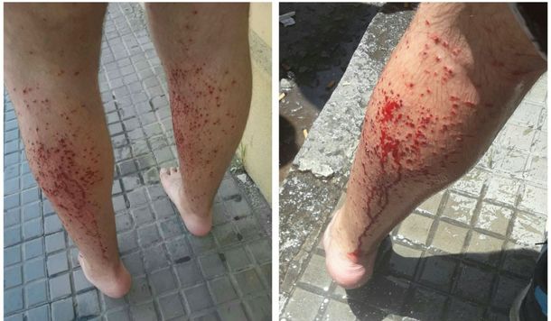 Así resultaron heridos los dos adolescentes