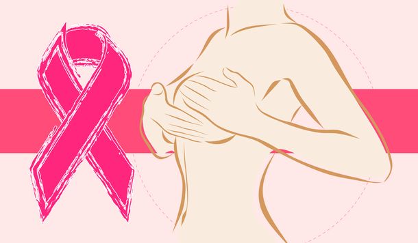 Trivia: ¿cuánto sabés sobre el cáncer de mama?
