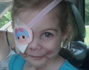 Indemnizan a una nena de 3 años por haberla echado de un restaurante por sus cicatrices