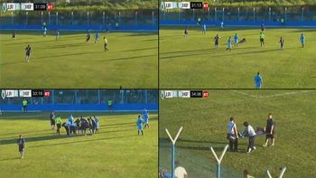 otra vez el juego brusco: mira la terrible fractura de un jugador del ascenso otra vez el juego brusco: mira la terrible fractura de un jugador del ascenso