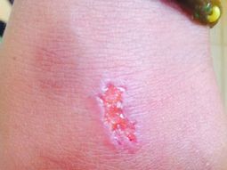 Este es el nuevo juego peligroso entre los adolescentes Este es el nuevo juego peligroso entre los adolescentes