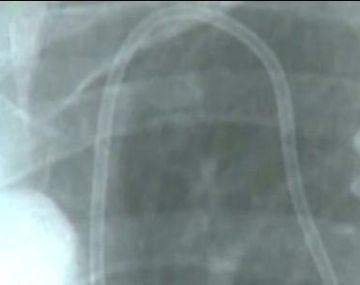 Jesus radiografia