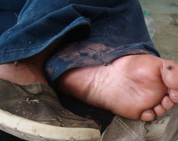 Aseguran que hubo pacientes comidos por los perros