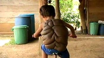 Niñotortuga 2 Niñotortuga 2