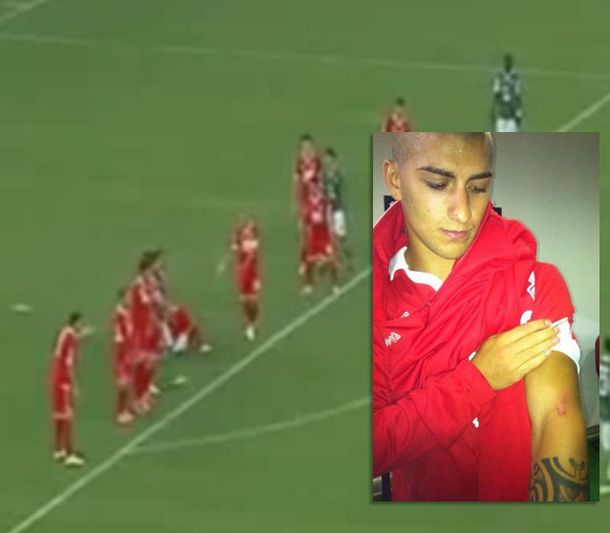 Un jugador italiano mordió a lo Suárez, pero expulsaron a su rival por protestar