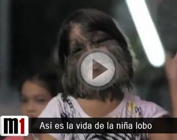 Niña lobo centro
