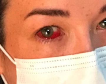 Brutal ataque de un albañil a una embarazada en un intento de robo