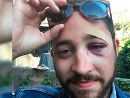 recibio una paliza por parecerse a un famoso actor de hollywood recibio una paliza por parecerse a un famoso actor de hollywood