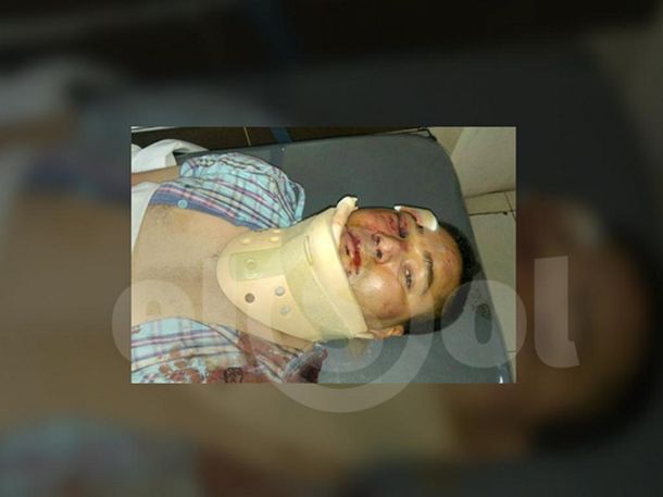 El policía atacado por los empleados de un taller. Crédito: El Sol