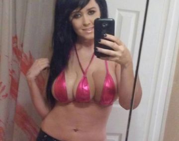 La mujer que se implantó un tercer pecho