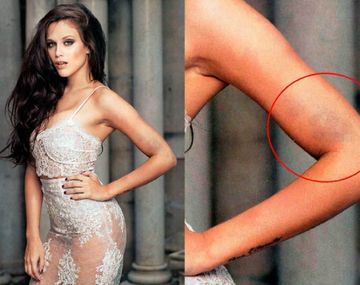 Estaba acostumbrada a posar con moretones y siempre me los tapaban