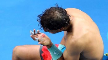 mira las fotos de la zurda de rafael nadal en carne viva mira las fotos de la zurda de rafael nadal en carne viva