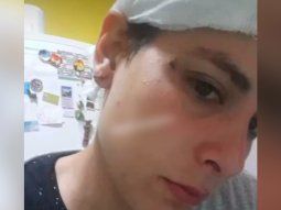 Así quedó la moza agredida con una botella en medio de una batalla campal en una parrilla de Ituzaingó
