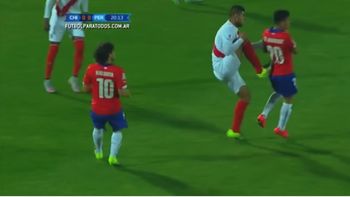 mira como quedo la espalda de aranguiz tras la brutal patada de zambrano mira como quedo la espalda de aranguiz tras la brutal patada de zambrano