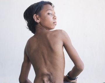 Devoción en la India por un niño que tiene rabo