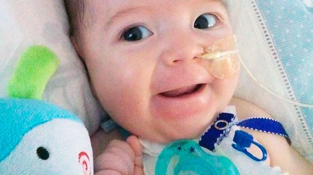 Piden ayuda para un bebé con una extraña enfermedad