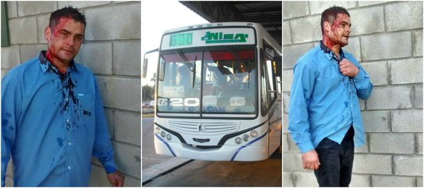 Así quedó el colectivero de la línea 620