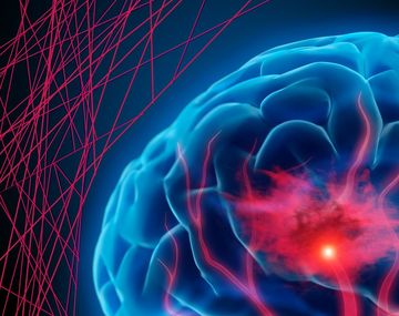 Hemorragias cerebrales