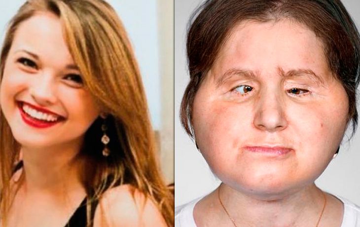 El antes y después de Katie