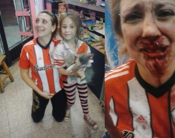 Una hincha de River fue salvajemente atacada por un fanático de Boca