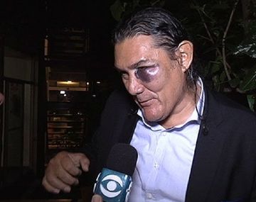 Venezuela: el DT le pegó una piña a un ayudante 