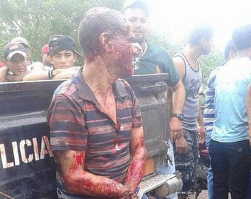 Un hombre decapitó a un joven y fue linchado por los vecinos en Nicaragua