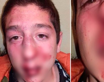 Patovicas le pegaron por error