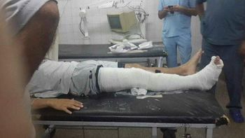 asi quedo carlos bueno tras la fuerte patada de orion asi quedo carlos bueno tras la fuerte patada de orion