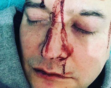 Brutal ataque homofóbico a Leo García