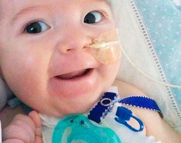 Piden ayuda para un bebé con una rara enfermedad