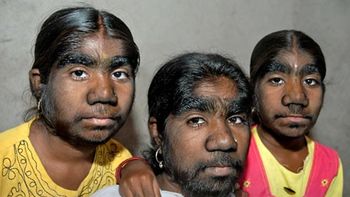 Gueparinas Gueparinas