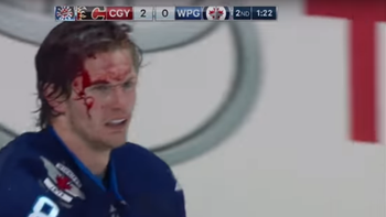 Una pelea en un partido de hockey sobre hielo terminó mal Una pelea en un partido de hockey sobre hielo terminó mal