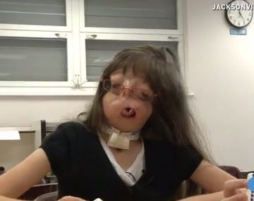 VIDEO: El conmovedor caso de una niña que nació sin cara